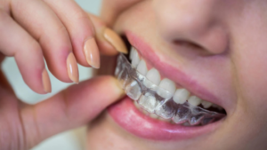 invisalign-dental services-luminous dental care-dentristry-dentist